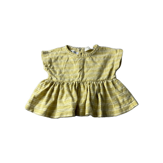 1 + in the family Girls Striped | Yellow Shirt Size: 3 months Striped | Yellow